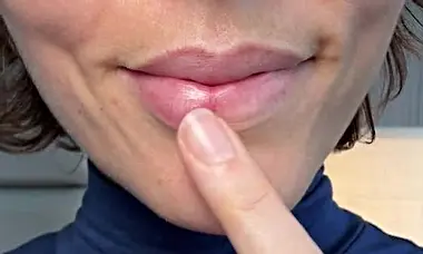 At Home Lip Plumping Device Has Beauticians Stunned