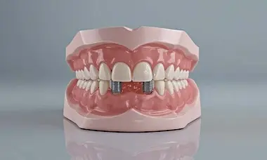 Search For Implant Supported Dentures Near Me (Check It Out)