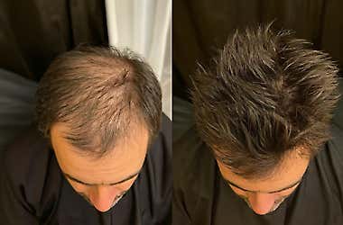 The Spray That’s Changing Men’s Lives