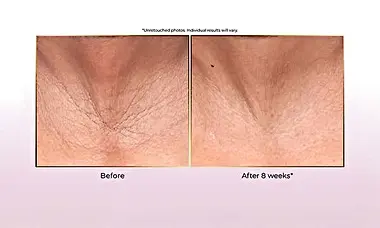 Achieve Results in Just 4 Weeks (See How)