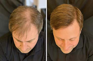 The Spray That’s Changing Men’s Lives