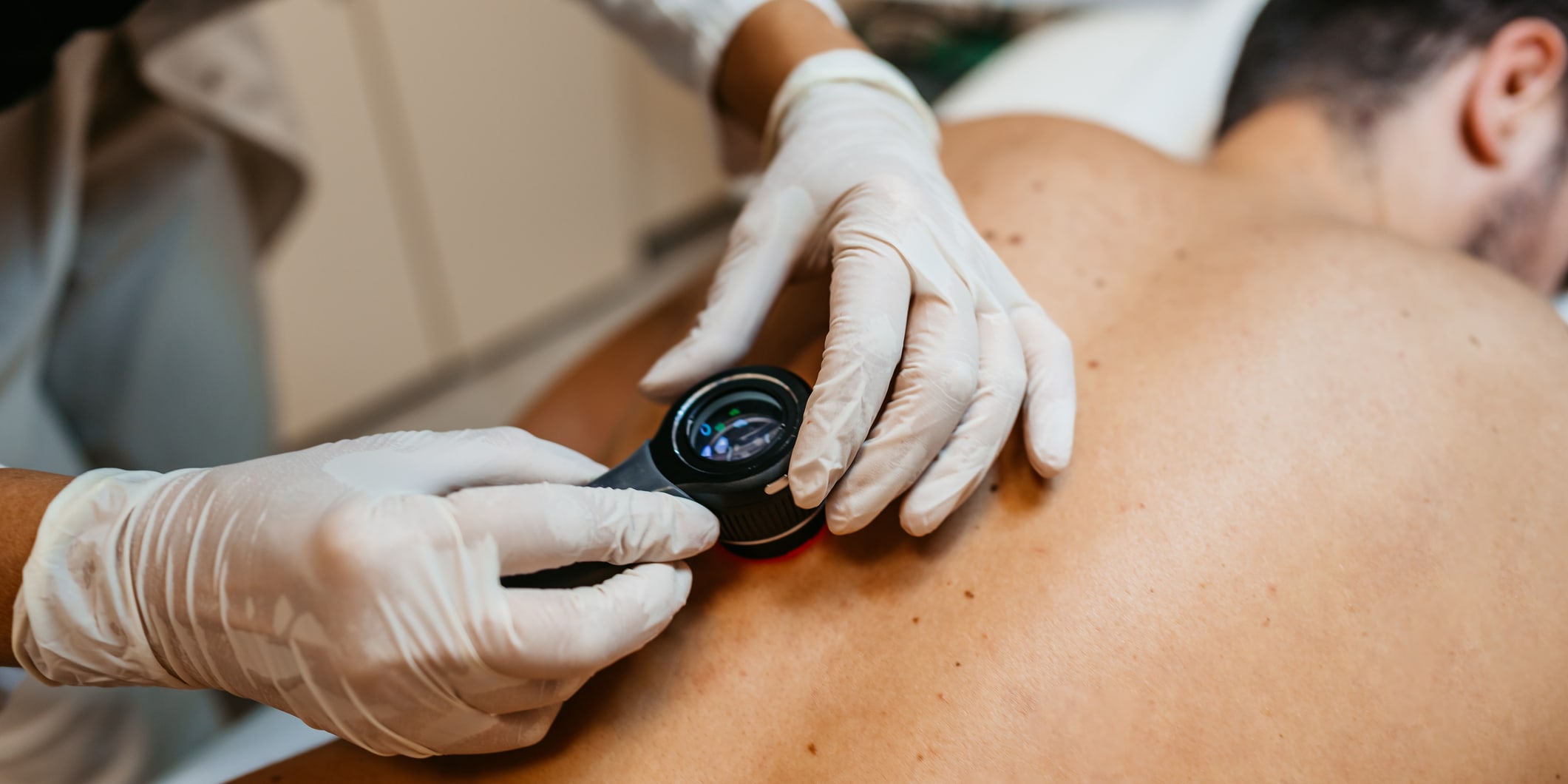 Signals of Squamous Cell Carcinoma You Shouldn’t Ignore...