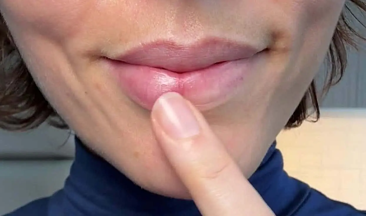 At Home Lip Plumping Device Has Beauticians Stunned