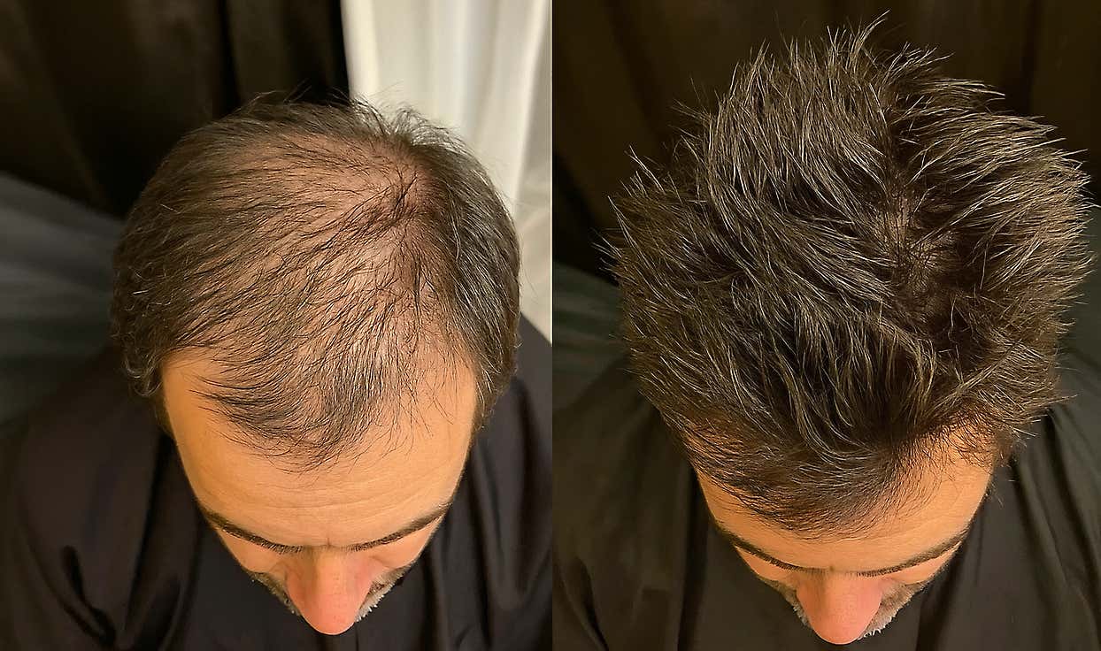 The Spray That’s Changing Men’s Lives