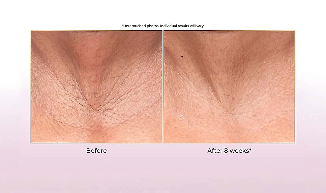 Achieve Results in Just 4 Weeks (See How)