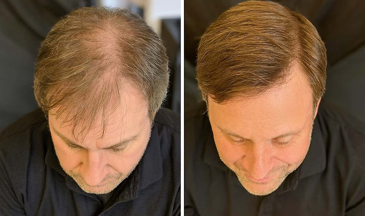 The Spray That’s Changing Men’s Lives