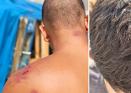 Amnistía Internacional denuncia “tortura y tratos crueles” de militares españoles a los migrantes en Ceuta: “Cuando terminaron, me tiraron por un terraplén”